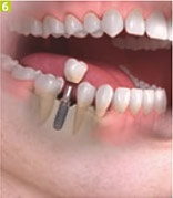 Azt akarom implantátumok fogászati Sumlinski (Sumlinski) Azt akarom implantátumok fogászati Sumlinski