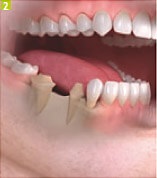Azt akarom implantátumok fogászati Sumlinski (beültetés Cseljabinszk fogak) Azt akarom implantátumok fogászati Sumlinski