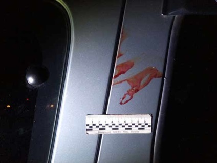 A brutális támadás egy taxis férfi majdnem elvágta a torkát - bűn- és baleset Ukrajnában