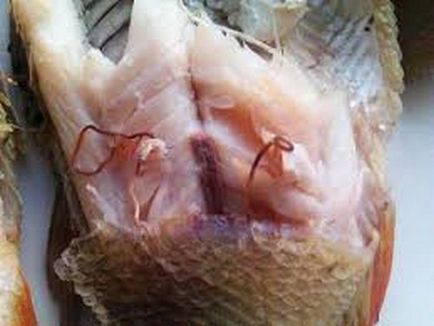 az emberre veszélyes halak féreg)
