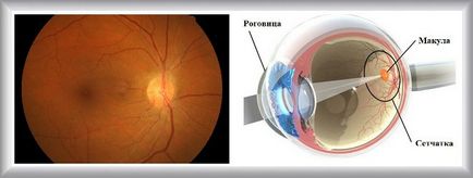 szem nélküli látástechnika milyen gyümölcsök erősítik a látást