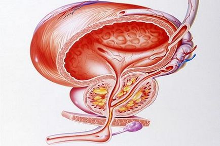 Genitális herpesz és prostatitis Prostatitis és kezelése piócával