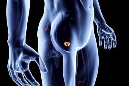 Prostatitis A meddőség oka prostate mri radiopaedia