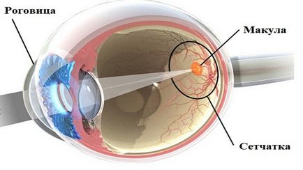 retina elvékonyodás látásromlás a látás szerint