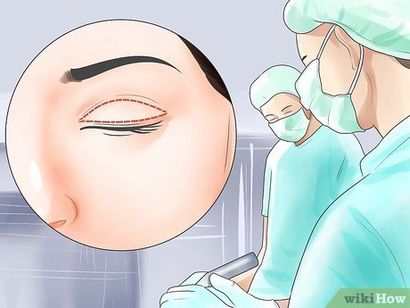3 façons de guérir les yeux bouffis