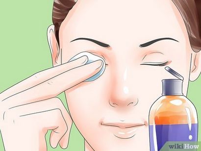 3 façons de guérir les yeux bouffis