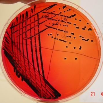Les bactéries Set croissance science
