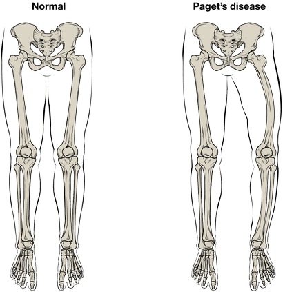 Knochenstruktur - Anatomie und Physiologie