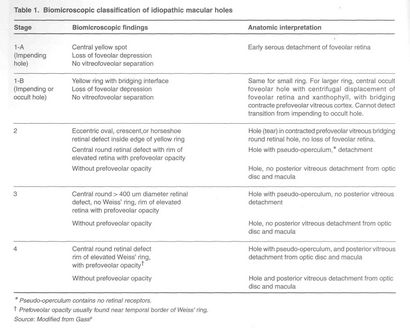 Le diagnostic et la gestion des trous maculaires idiopathiques Saxena S, Holekamp NM, Kumar A - J indienne