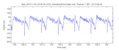 EEG Hacker maison passive Electrodes