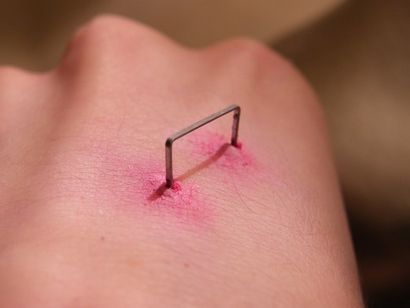 Blessures Faux Faire couteaux et objets plaies par arme blanche de décollées (Comment faire une blessure Staple), (blessures) Blessures Faux Faire blessures par arme blanche Couteau et objets décollées (Comment faire une Plaie d'agrafes),