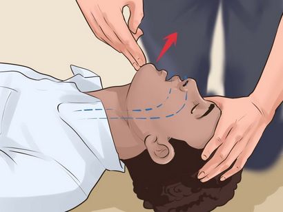 Wie Erste-Hilfe zu tun - VripMaster