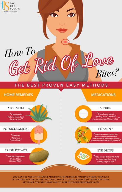 Wie Rid Of Love Bites Get überprüfen Sie die besten Bewährte einfache Methoden
