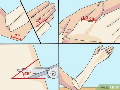 Wie man ein Pflaster Machen eines Arm Cast 14 Stufen (mit Bildern)
