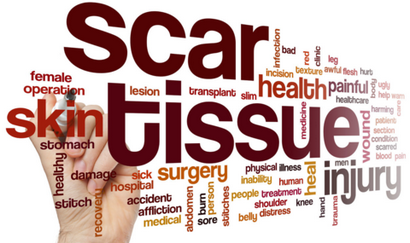Comment faire Cicatrices Disappear - InstaNatural (disparaître) Comment faire Cicatrices Disappear - InstaNatural