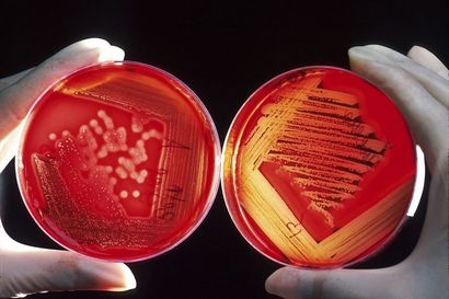 Wie Streak zu einer Bakterienkultur