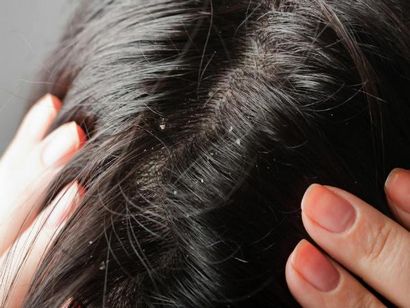 Wie Verwenden von Hibiscus Öl für Haar