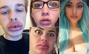 Kylie Jenner défi voit les adolescents sucer des lunettes de tir pour faire sauter leurs lèvres, Daily Mail en ligne