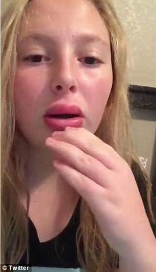 Kylie Jenner défi voit les adolescents sucer des lunettes de tir pour faire sauter leurs lèvres, Daily Mail en ligne