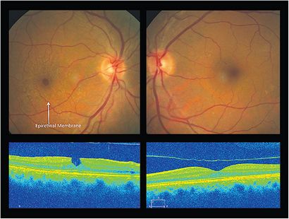 Optometric-Management