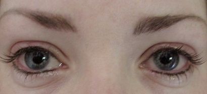 Eyeliner permanent - Complications Évite