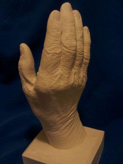 Gips Alginate Casts von My Hand DIY 5 Schritte (mit Bildern)