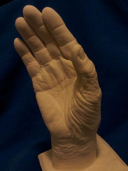 Gips Alginate Casts von My Hand DIY 5 Schritte (mit Bildern)