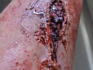 Realistic Wound FX 7 Schritte (mit Bildern)