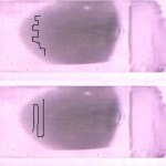 Examen Étaler, eClinpath