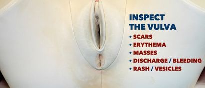 L'examen vaginal (PV) - Guide de l'OSCE, Geeky Medics