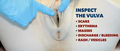 L'examen vaginal (PV) - Guide de l'OSCE, Geeky Medics