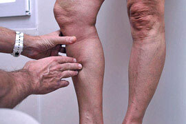 Levage de poids (Résistance exercice) Santé et prévention des maladies - Combien puis-je augmenter (la maladie) Levage de poids (Résistance exercice) Santé et prévention des maladies - Combien puis-je augmenter