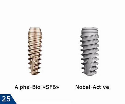 Alpha Bio implantátum - alfa-bio Izrael véleménye és az ár 2017 előnyök