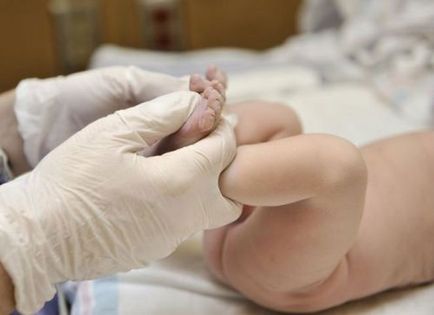 Gipertonus csecsemők fokozott izomtónus újszülöttek