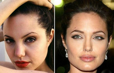 Hogyan változtassuk meg, hogy valaki vonzóbb, ha lehet teljesen megváltoztatni az arcát plasztikai
