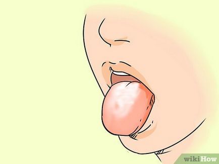 Hogyan lehet eltávolítani a fehér bevonat a nyelv