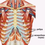 Bordaközi neuralgia tünetek és a kezelés otthon