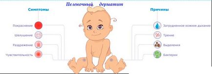 Pelenka dermatitis csecsemők - Okok, kezelés