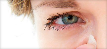 Miért okoz viszketést szemek, viszketés kezelésére, tünetek