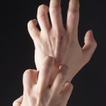 Miért kiváló a bőr a kézen és megszárad, és mit kell tenni, ha száraz