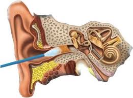 Tinnitus kezelés otthon - 35 recept!