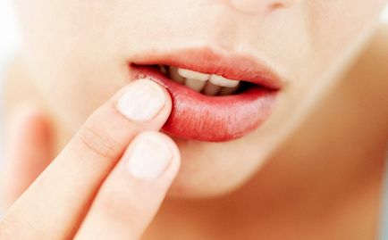 Tanácsot, hogyan lehet növelni az ajkak műtét nélkül