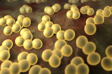 Staphylococcus aureus a torokban tünetek, kezelés bakteriofág fotó