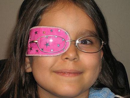 Amblyopia - ez tompalátás a gyermekek és a kezelés mértékét