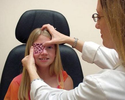Amblyopia - ez tompalátás a gyermekek és a kezelés mértékét