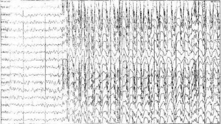 Audionarkotiki, digitális gyógyszerek, audio gyógyszerek audionarkotiki ingyenesen letölthető (audionarkotiki) Audionarkotiki, digitális gyógyszerek, audio gyógyszerek audionarkotiki ingyenesen letölthető,