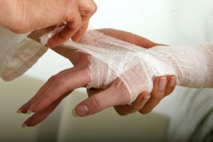Mi a teendő, ha egy vágott láb, a kéz vagy az arc, elsősegély vágások, népi jogorvoslati kezelésére
