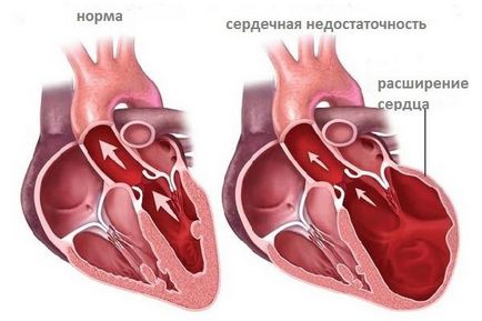 Diffúz cardio okok, tünetek, kezelés