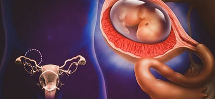 Doppler ultrahang terhesség mi ez, hogyan