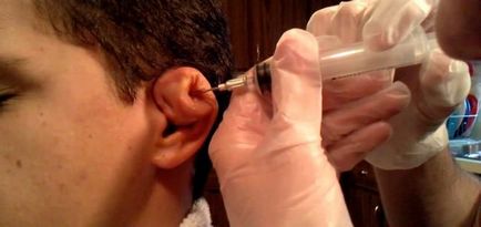Hogyan lehet megtörni a fül károsíthatja a porc Do